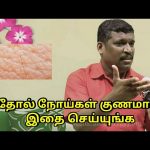 தோல் நோய்கள் குணமாக இதை செய்யுங்க | Skin disease treatment by Healer Baskar