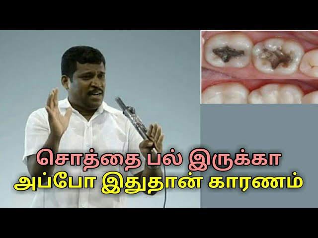 சொத்தை பல் குணமாக இதை செய்யுங்க | Healer baskar speech on Tooth decay treatment