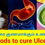 வயிற்றுப்புண்ணை குணமாக்கும் உணவுகள் | Foods to cure Ulcer | Home remedy for ulcer