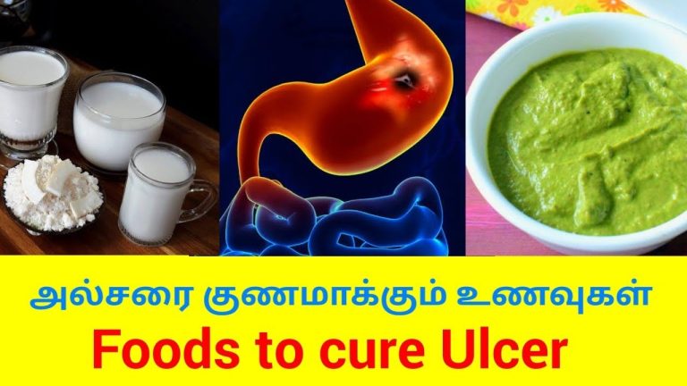 வயிற்றுப்புண்ணை குணமாக்கும் உணவுகள் | Foods to cure Ulcer | Home remedy for ulcer