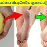 பாத வெடிப்பு குணமாக வீட்டு மருத்துவம் | Foot crack home remedy